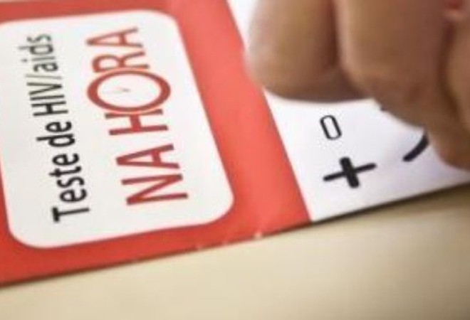 Anvisa libera registro de teste rápido de HIV para venda em farmácias