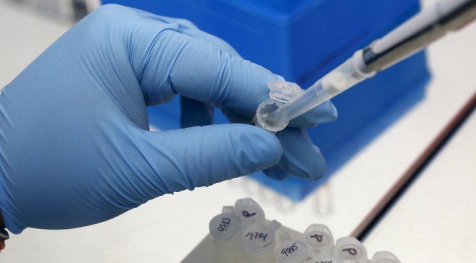 Anvisa registra teste rápido para detecção do vírus Zika em até 20 minutos