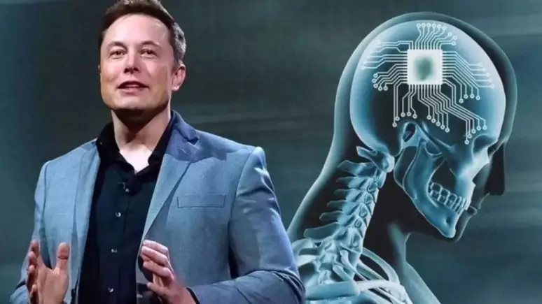 Ellon Musk e Humano com Chip